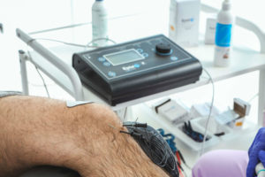 EPTE BIPOLAR SYSTEM ROTURAS FIBRILARES SISTEMA MULTIFILAR